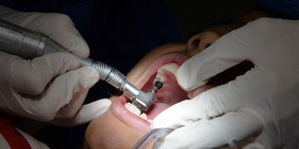 profissional dentista realiza atendimento em paciente que está com a boca aberta